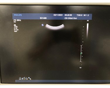 Philips - C5-1 [Ultrasound Transducer] - [EX2523]
