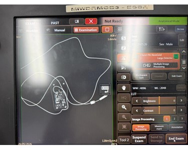 Shimadzu - MobileDaRt Evolution EX4687