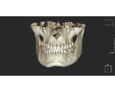 KaVo - Dental 3D Imaging System | OP 3D 