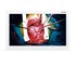 Medical Monitor ASM27FHB
