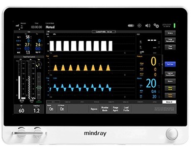 Mindray - Anesthesia System A9 | Anesthesia Workstation