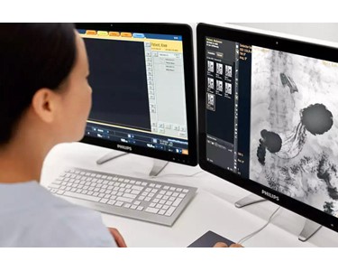 Philips - Fluoroscopy System | ProxiDiagnost N90