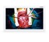 Medical Monitor ASM27UHB