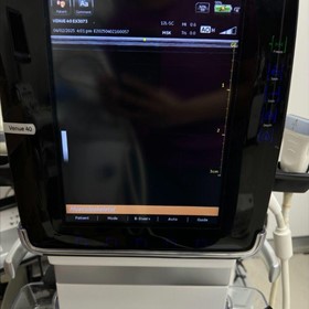 Venue 40 | Ultrasound Machine | EX3073