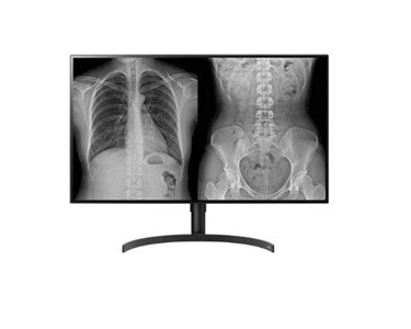 LG - Diagnostic Monitor | LGE-32HL512D-B