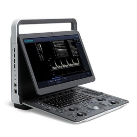 Ultrasound System | E1