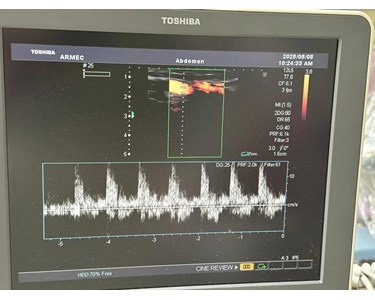 Toshiba - Xario Ultrasound | Ultrasound Machine | NEX335
