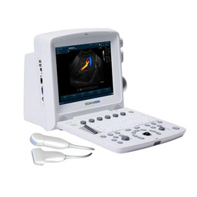 Ultrasound Machine U50 Colour Doppler