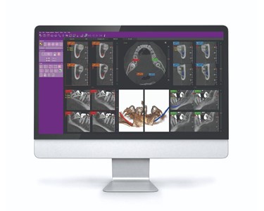 MyRay - 3D CBCT Imaging System – MyRay ProXima X6
