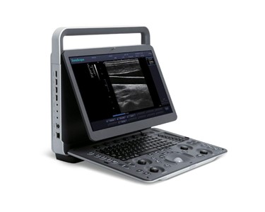 SonoScape - E1 Ultrasound Machine