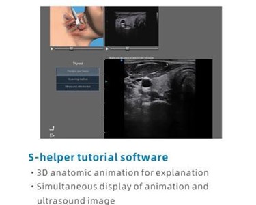 SIUI - Apogee 2100 Plus Digital Color Doppler Ultrasound Imaging System
