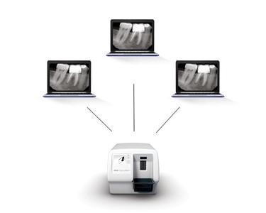 KaVo - Image Plate Scanner | Scan eXam