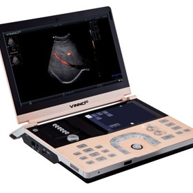 Portable Ultrasound System | V10 | Laptop-style 