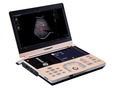 Vinno - Portable Ultrasound System | V10 | Laptop-style 