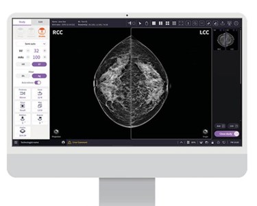 Mammgraphy - Mammography HESTIA T
