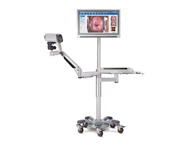 AI HD Gynaecology Colposcope | C6A