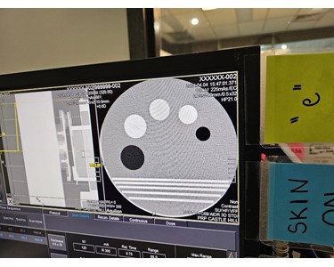 Toshiba - Aquilion 64 Slice [CT Scanner] – Upgraded to CXL [EX3615]