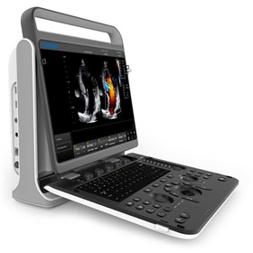 Veterinary Ultrasound Machine & Scanner | EBit 50