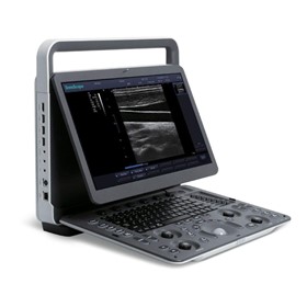 Sonoscape E1 Ultrasound Unit