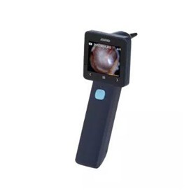 Portable Video Otoscope
