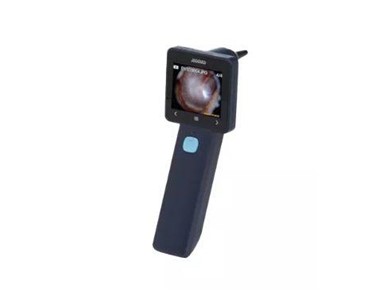 Inventis - Portable Video Otoscope