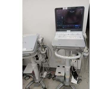 Toshiba - Viamo Ultrasound | Ultrasound Machine | EX4545