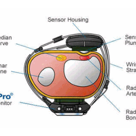 BPro EVBP Technology