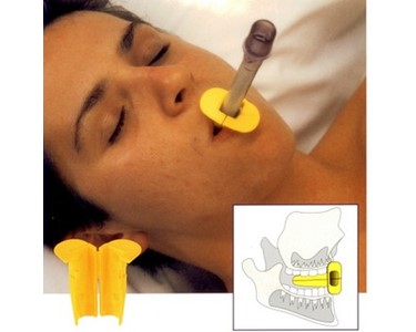 SafeBite Incisor Bite Protector