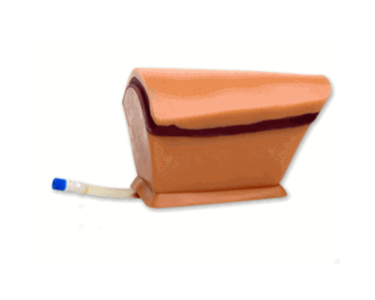 Thoracentesis Ultrasound Replacement Tissue