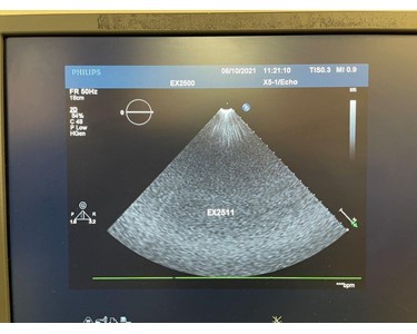 Philips - X5-1 [Ultrasound Transducer] [EX2511]