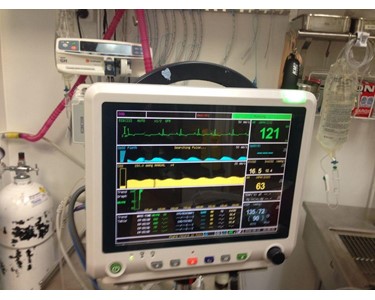 UTMD - 12" Multiparameters Veterinary Patient Monitor with ECG Resp | PM6000P