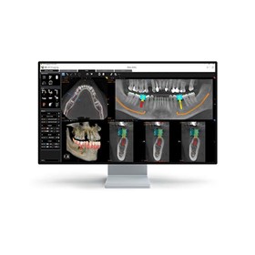 Dental 3D Imaging System | CS 8200 3D Advance