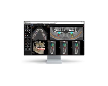 Carestream Dental - Dental 3D Imaging System | CS 8200 3D Advance