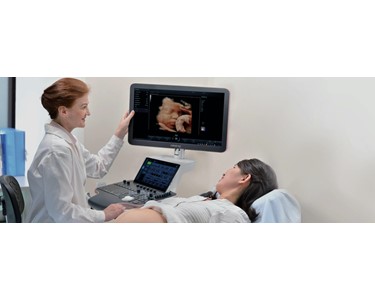 Mindray - Premium Ultrasound System | Nuewa R9