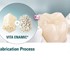 Dental Milling Material | ENAMIC® multiColor for CEREC/inLab, HT