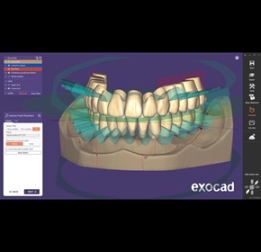 Dental Imaging Software | Stand Alone - Full Denture incl. Ivotion Add-On