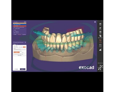 ExoCad - Dental Imaging Software | Stand Alone - Full Denture incl. Ivotion Add-On