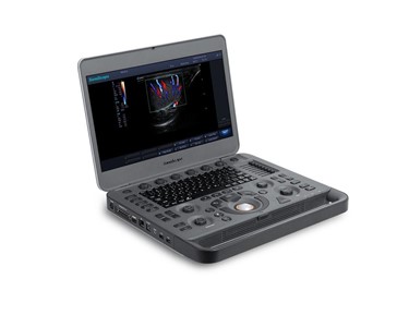 SonoScape - Ultrasound System | X3