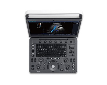 SonoScape - Portable Ultrasound System | E2