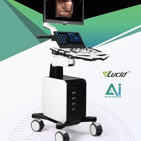 Ultrasound System | S300 