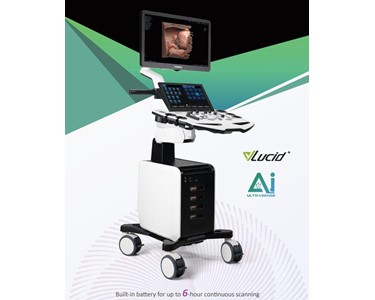 Vinno - Ultrasound System | S300 