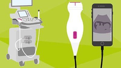Ultrasound Innovation: How Can We Keep Up?