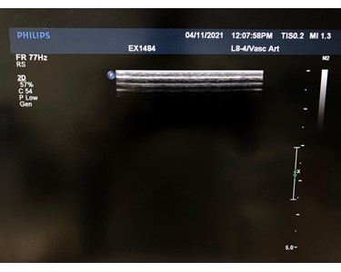 Philips - L8-4 | Linear Transducer | EX2571