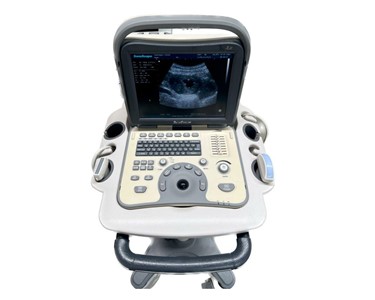 SonoScape -  Ultrasound Machine | A6 Portable
