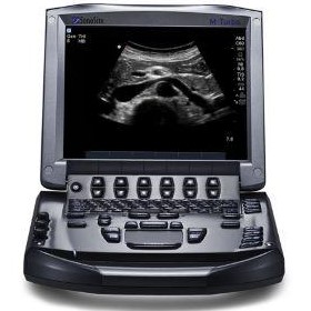 Portable Ultrasound Machine - M-Turbo