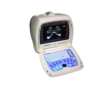 Diagnostic Ultrasound Machine