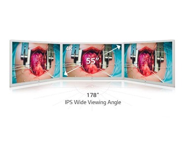 LG - Surgical Display | LGE-55MH5K-W
