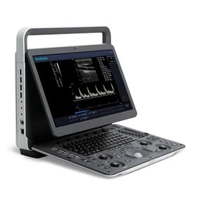 E1 Portable Ultrasound Machine