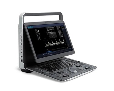 SonoScape - E1 Portable Ultrasound Machine