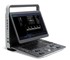 SonoScape - E1 Portable Ultrasound Machine